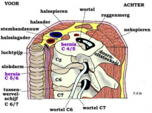 Bureaustoelen voor een hernia